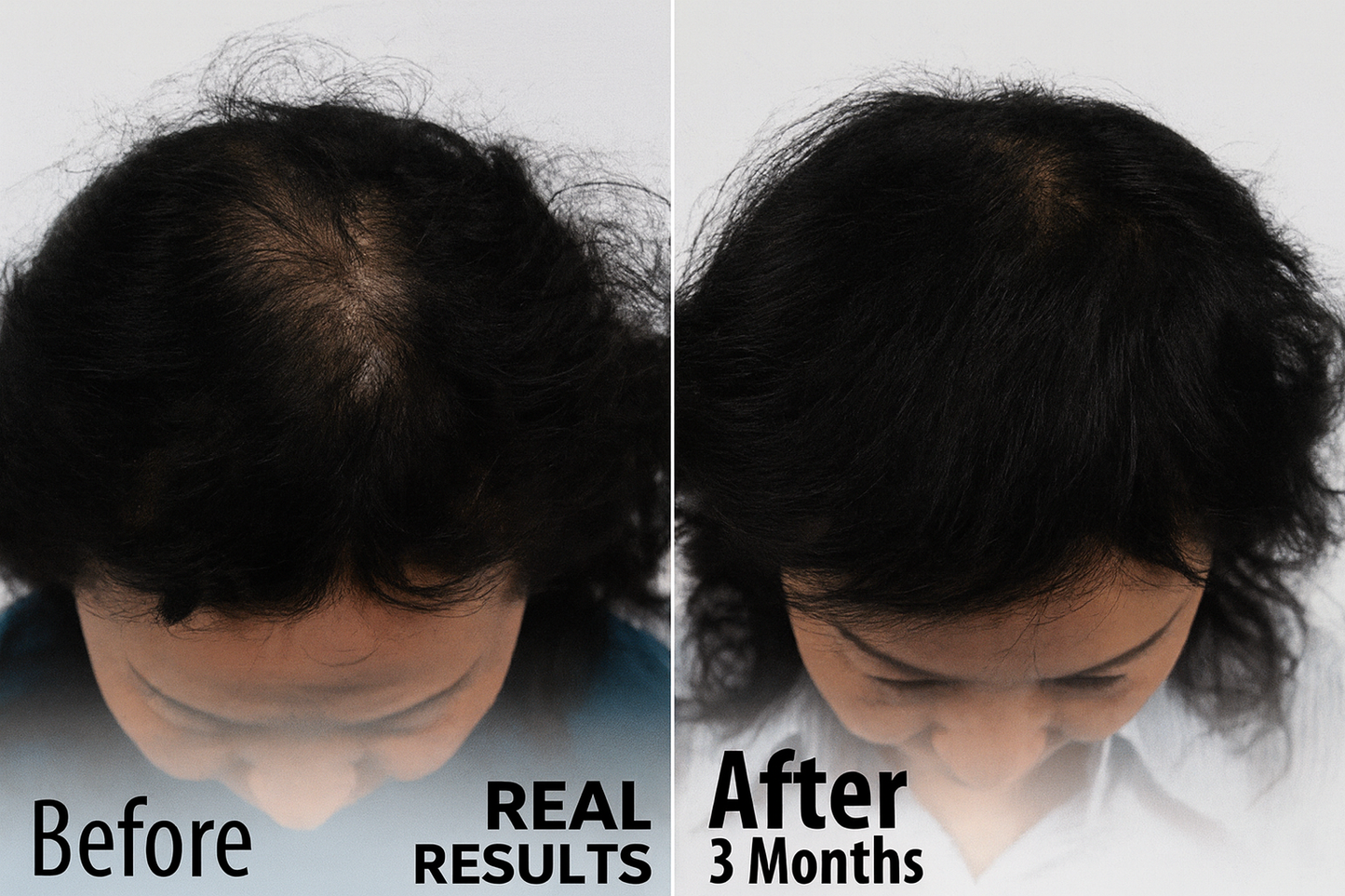 Hair Growth Accelerator